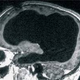 Image for article titled A civil servant missing most of his brain challenges our most basic theories of consciousness